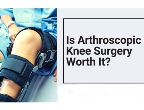 Is Arthroscopic Surgery Worth It?