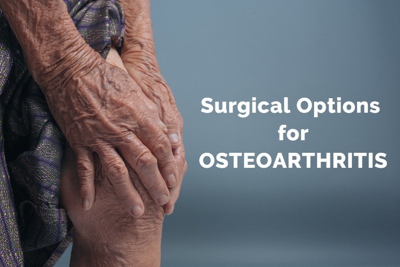 Surgical options for Osteoarthritis