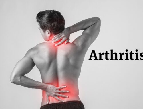 How Can You Prevent Arthritis?