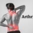 Best Treatment for Arthritis in Pune