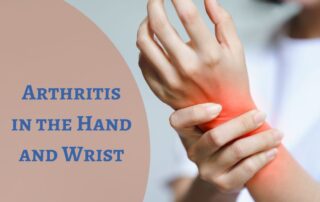 what are the treatments for Arthritis in hand and wrist