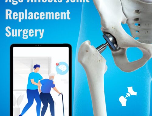 How Age Affects Joint Replacement Surgery