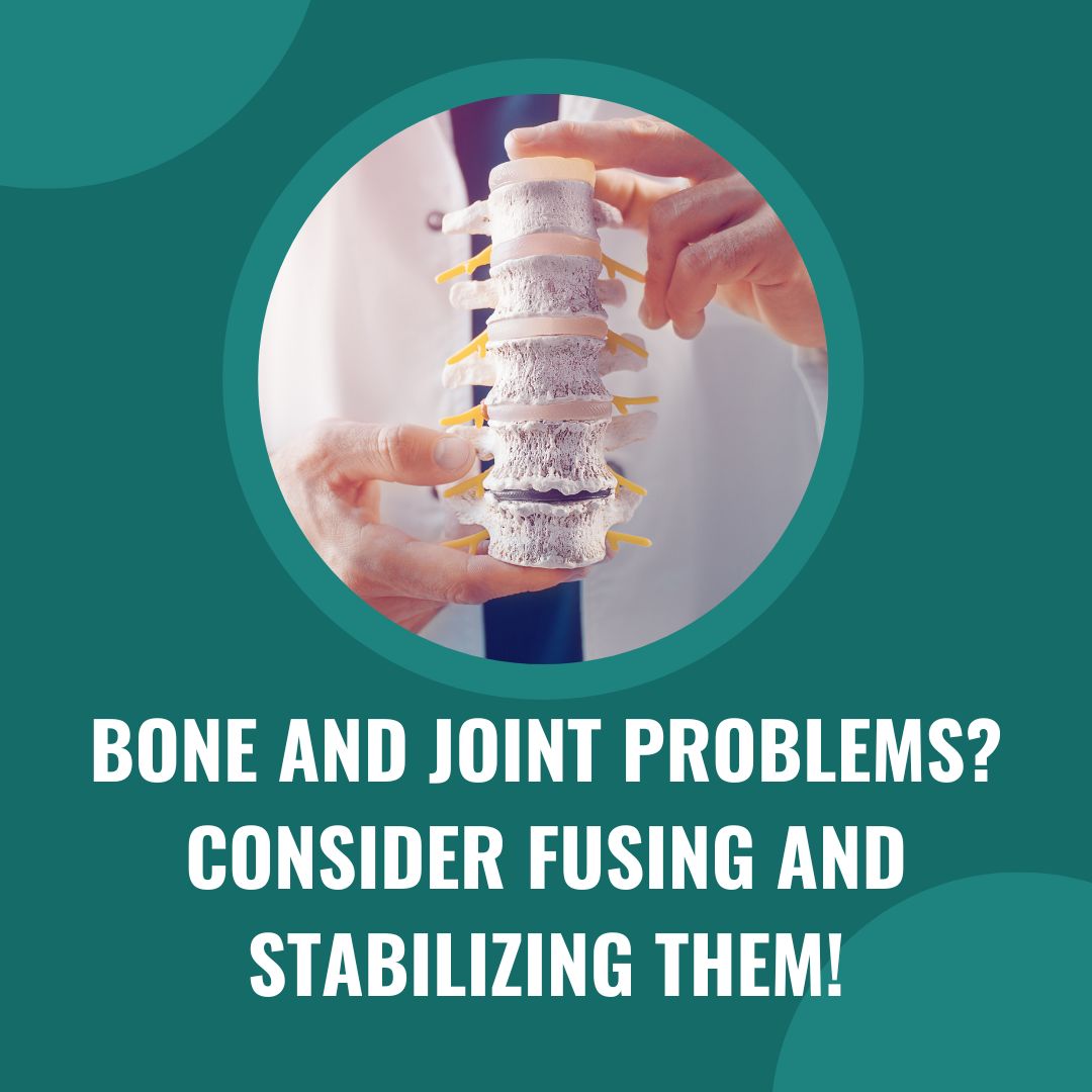 Fusion and Stabilization for Bone and joint problems