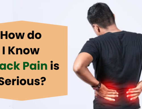 How do I Know if Back Pain is Serious?