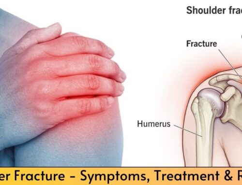 Shoulder Fracture – Symptoms, Treatment & Recovery